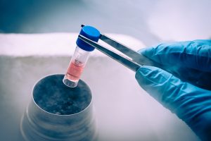 Sclerosi multipla, trapianto di staminali cerebrali su 15 pazienti: nuove speranze di trattamento