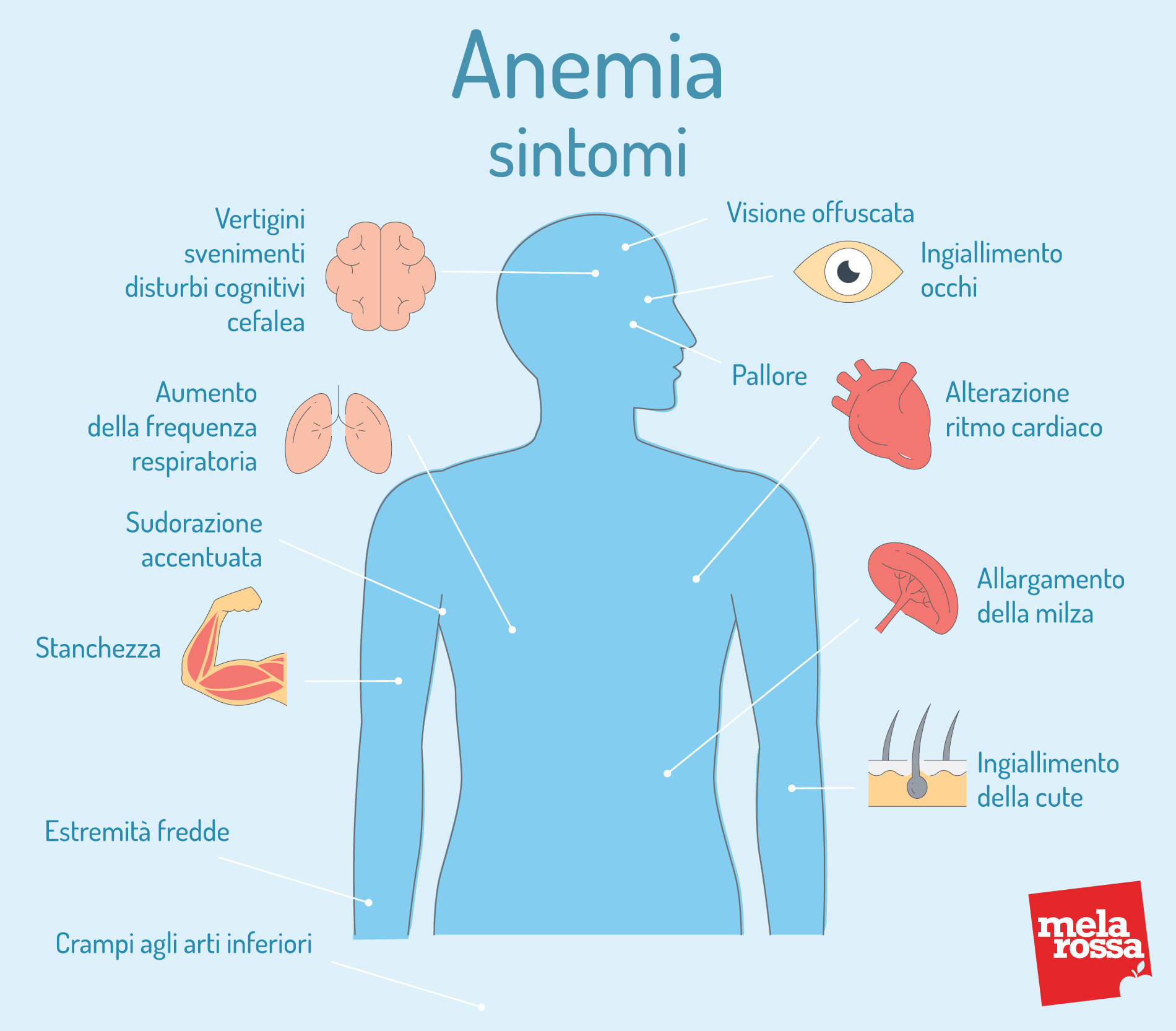 anemia sintomi