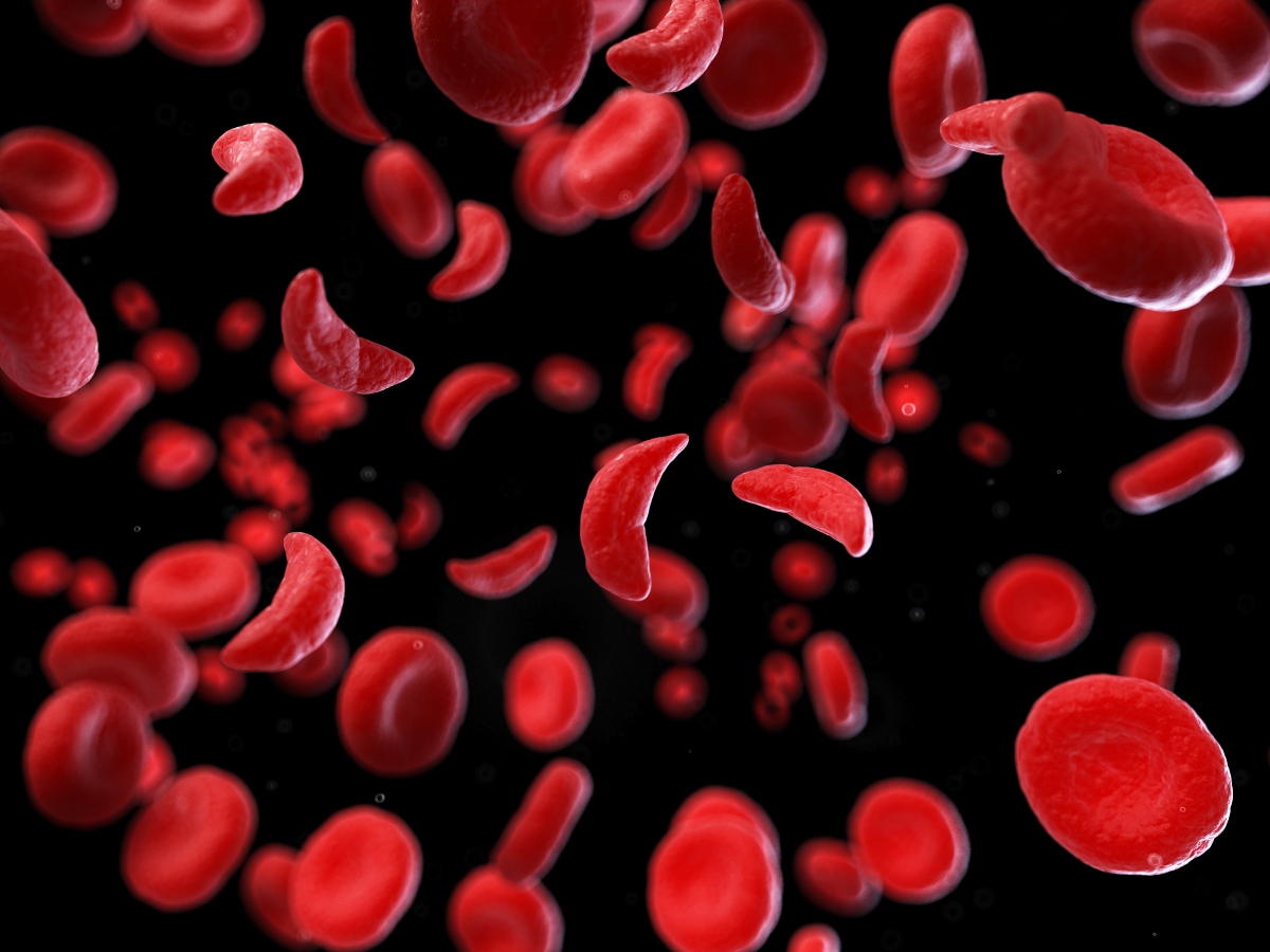 anemia e globuli rossi 