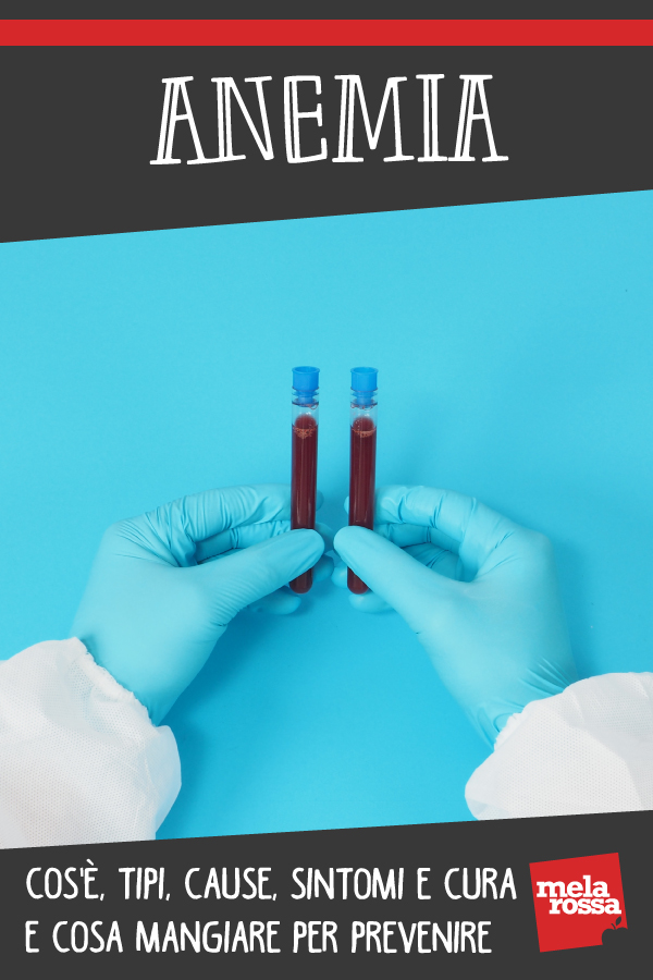 anemia: cos'è, tipi, cause, sintomi e cure