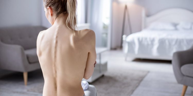 Anoressia, c'è un'arma in più: scoperto gene da colpire coi farmaci per combatterla