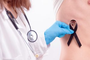 Melanoma: circa il 90% di guarigioni, ma aumentano i casi tra gli under 40