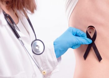 melanoma