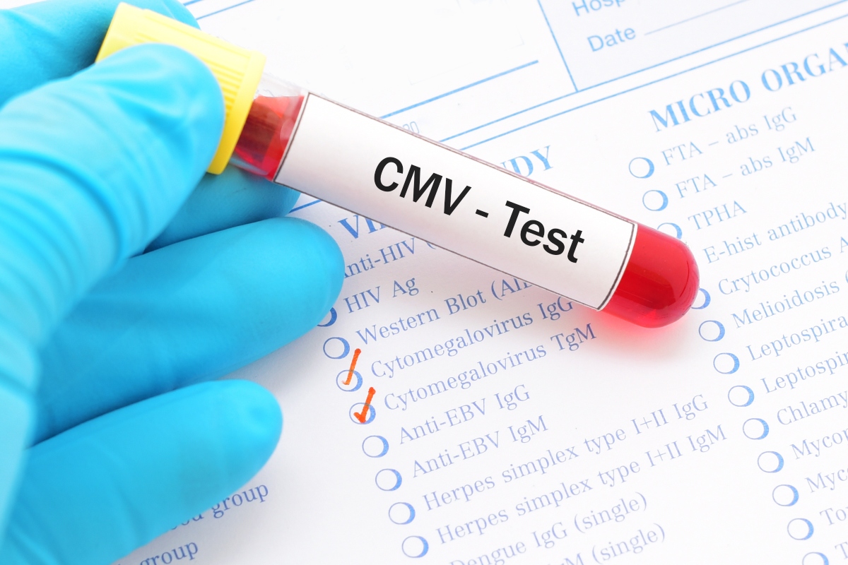 citomegalovirus:test