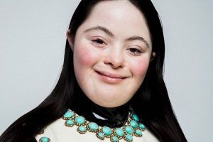 Ellie Goldstein, una bellezza non convenzionale per Gucci: la modella con sindrome di Down nuovo testimonial beauty