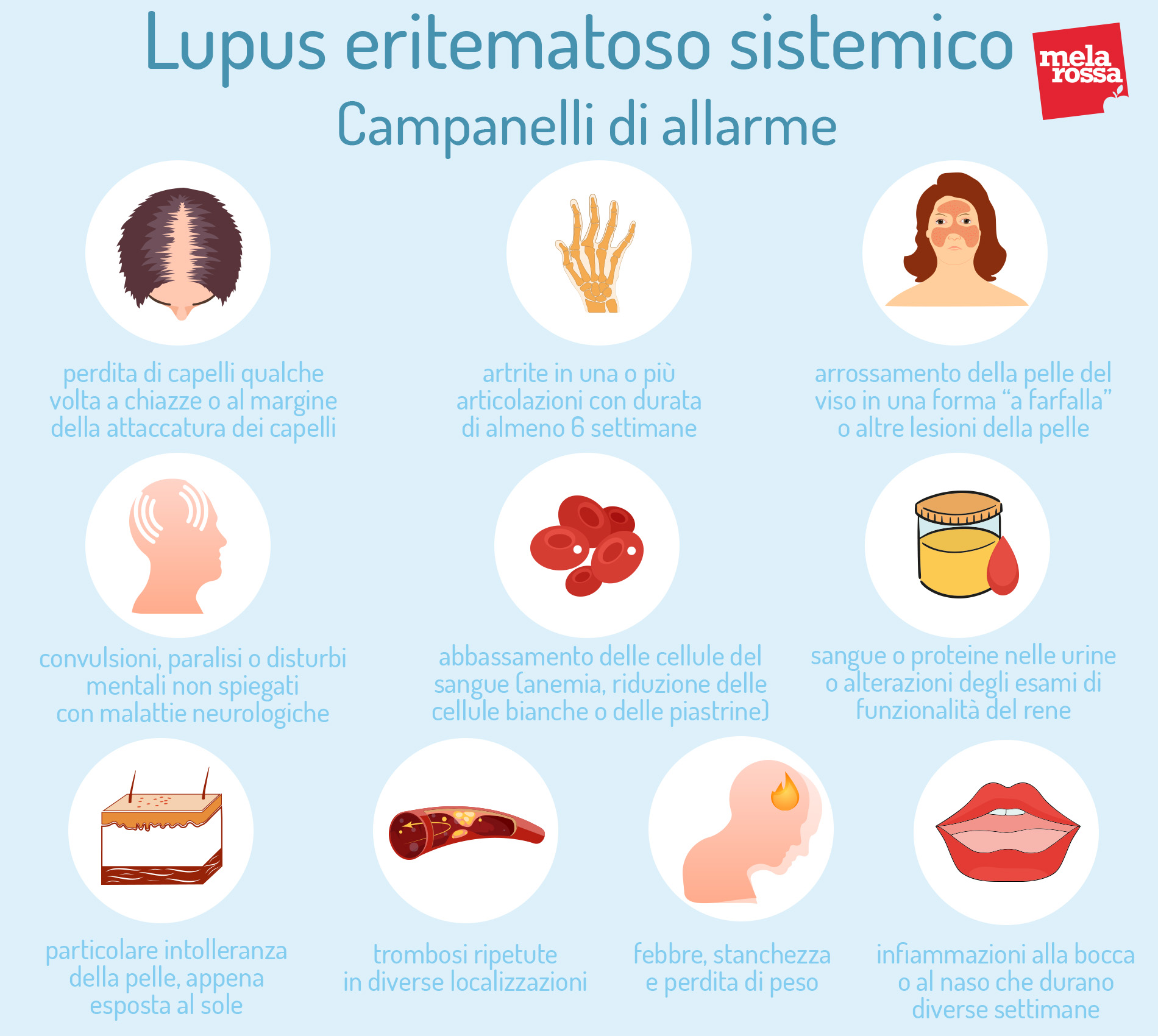 Lupus: campanelli d'allarme