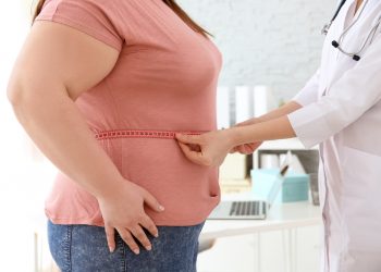 obesita demenza senile