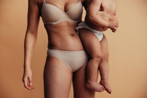 Smagliature: cosa sono, cause, rimedi e trattamenti a casa e dal dermatologo, dieta e prevenzione
