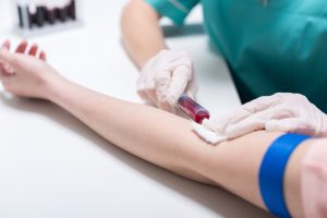 Trigliceridi alti: valori preoccupanti, esami da fare, cosa mangiare, farmaci