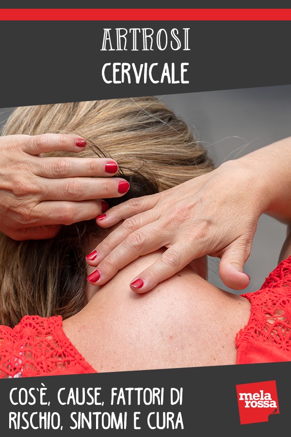 artrosi cervicale: cos'è, cause e sintomi