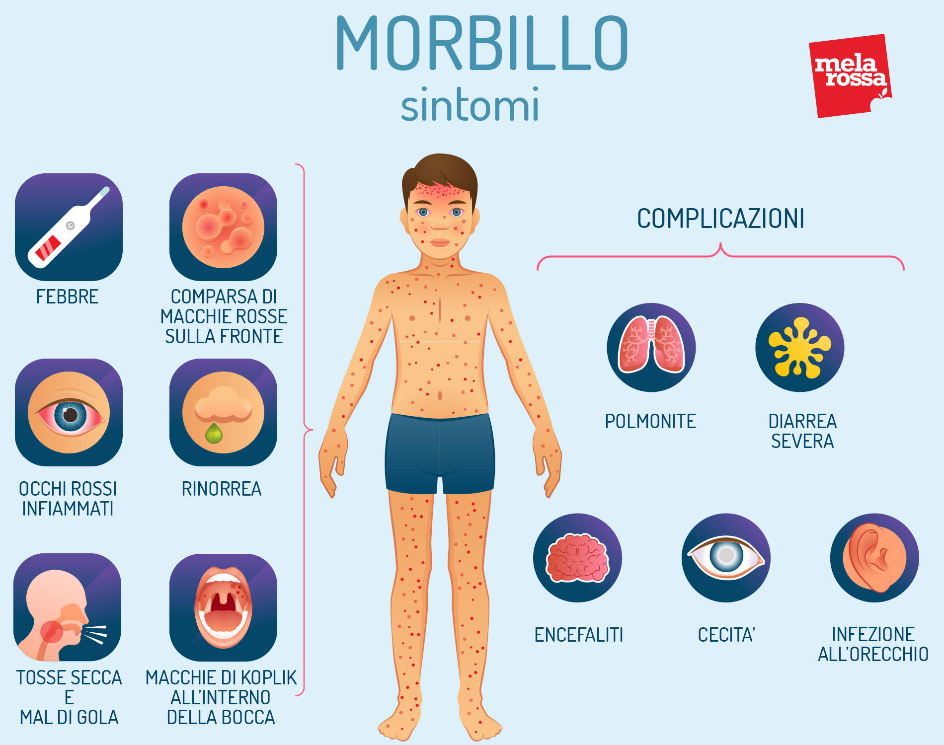 Morbillo: sintomi e complicazioni