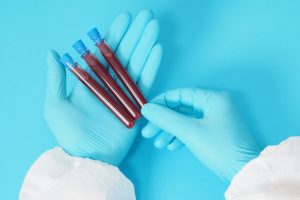 Trigliceridi bassi: cosa significa, quali sono i sintomi, le cause e le possibili conseguenze
