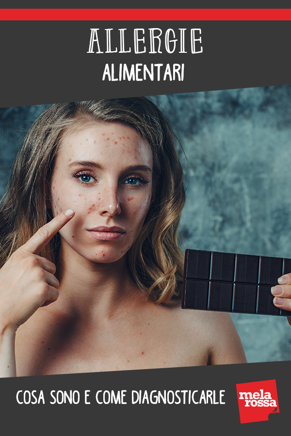 allergie alimentari 1