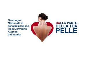 Dermatite atopica: il 26 settembre parte la campagna “Dalla parte della tua pelle”
