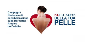 Dermatite atopica: il 26 settembre parte la campagna "Dalla parte della tua pelle"