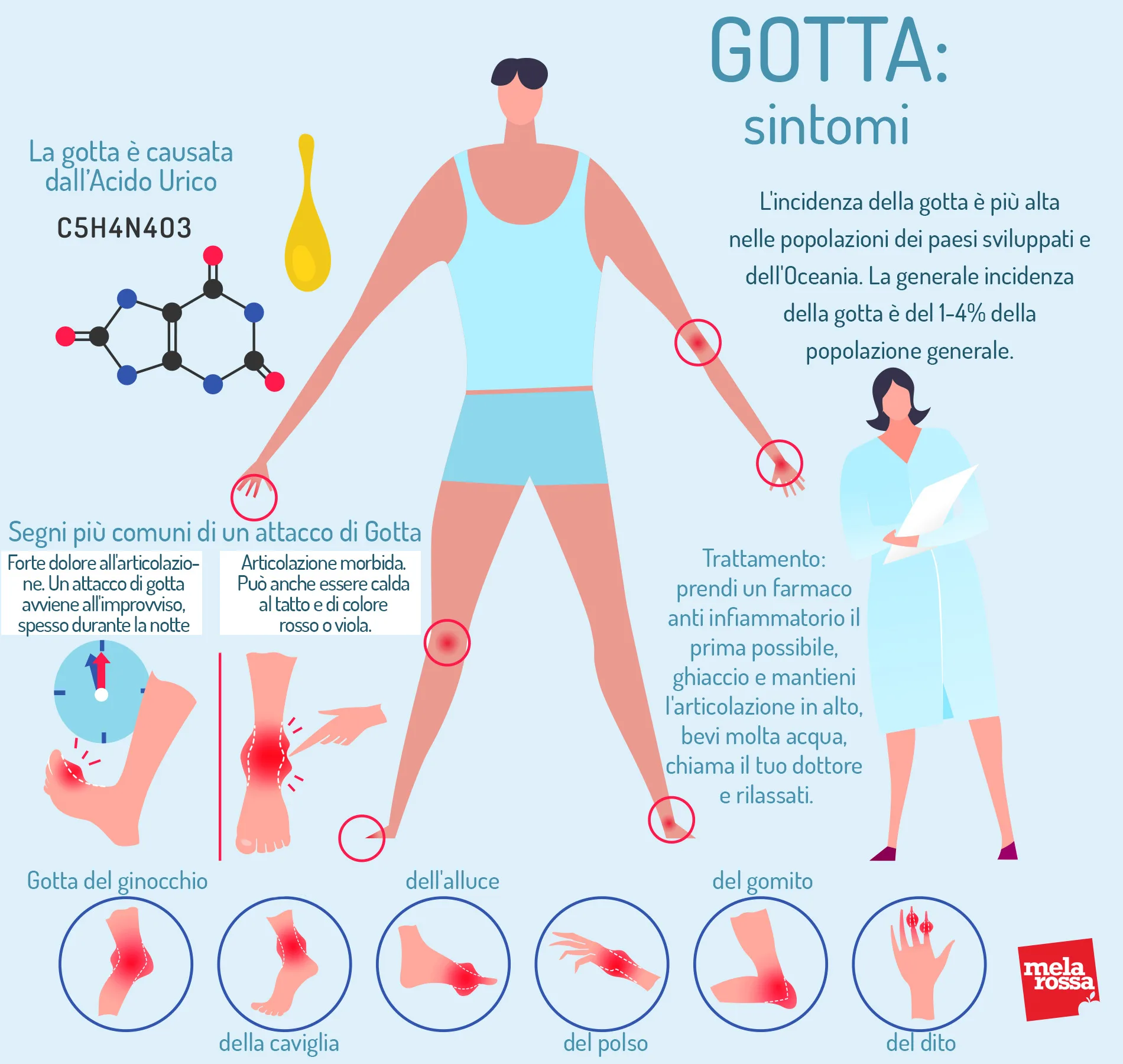 Gotta Cos E Cause Sintomi Cure E Prevenzione Melarossa