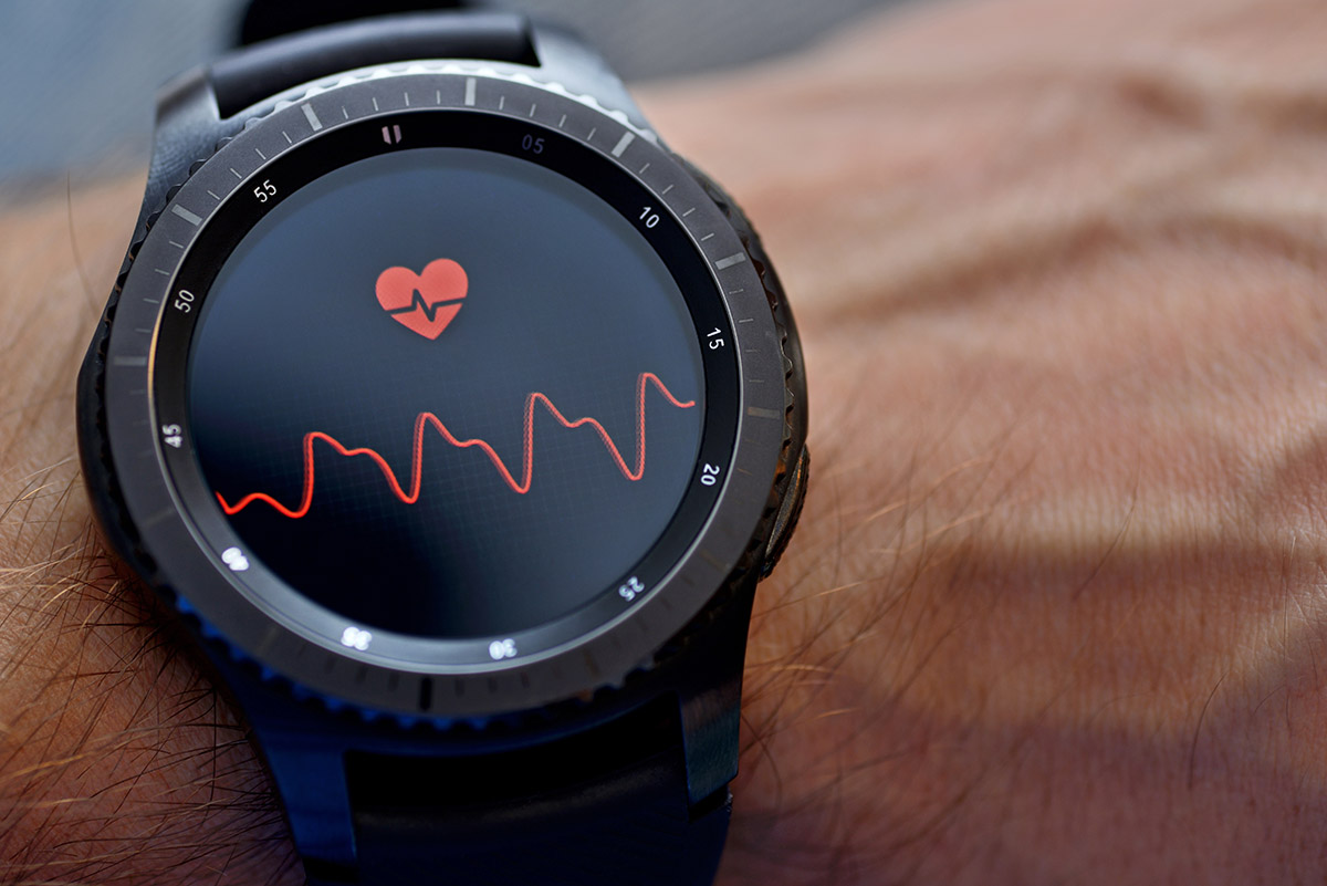 infarto smartwatch2