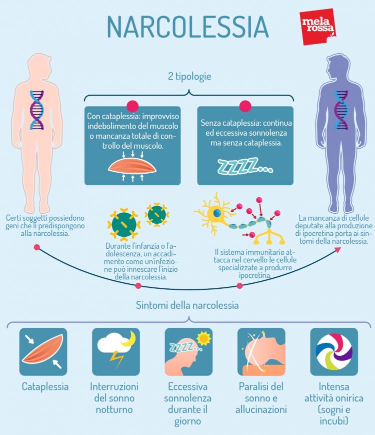 Narcolessia cos'è, cause, sintomi, diagnosi e cure