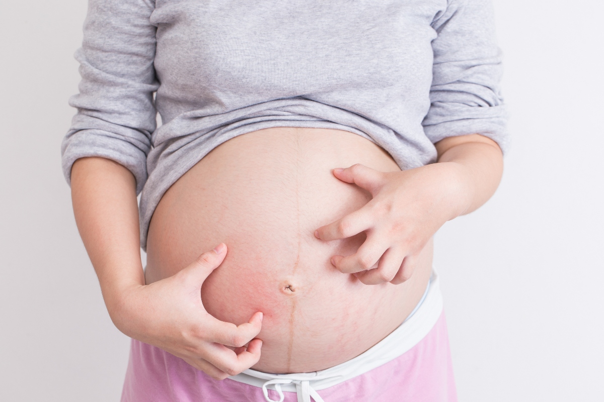 quinta malattia in gravidanza
