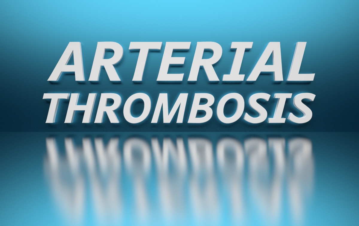 trombosi arteriosa