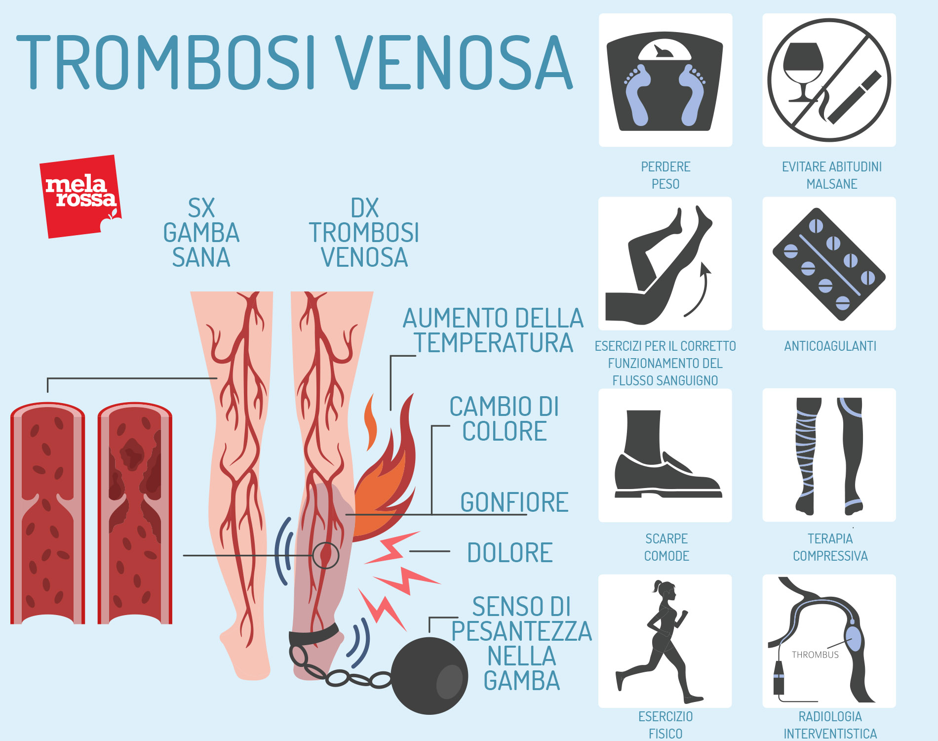 trombosi venosa: infografica 