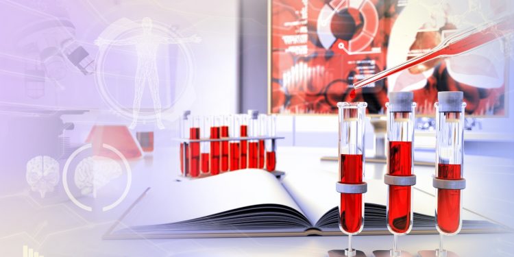 tre provette per il test sui trigliceridi