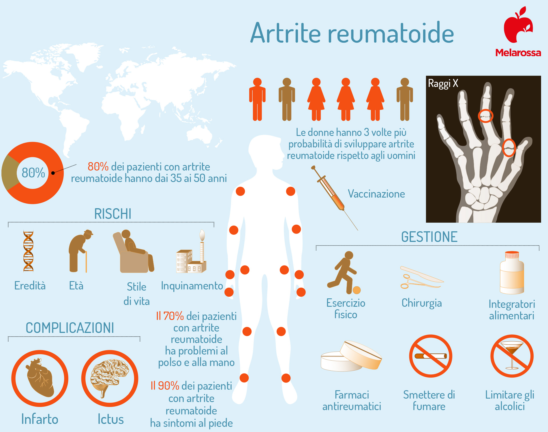 artrite reumatoide: infografica