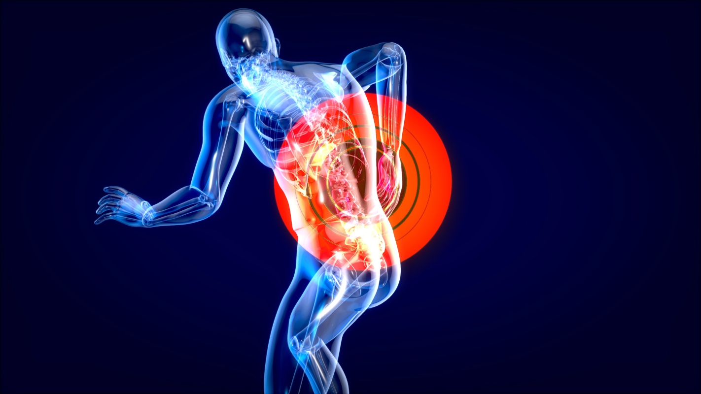 le cause della fibromialgia