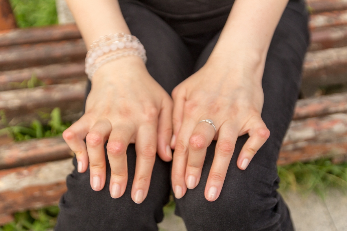 fibromialgia e artrite reumatoide