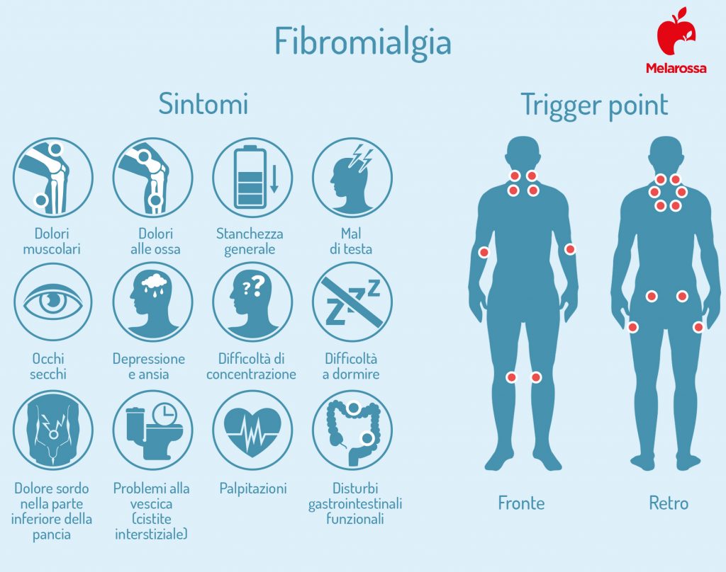 fibromialgia: sintomi e trigger point
