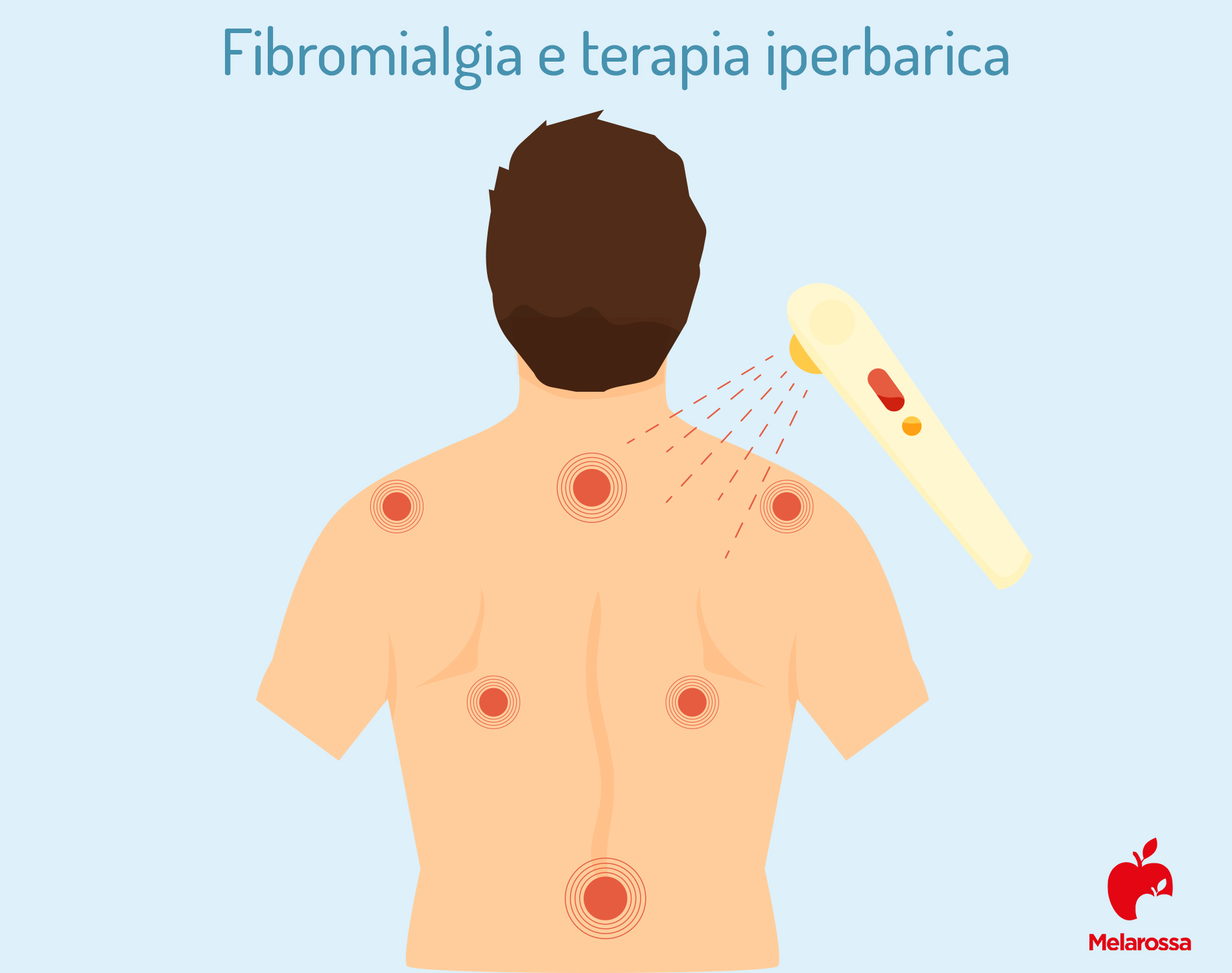 fibromialgia e terapia iperbarica 