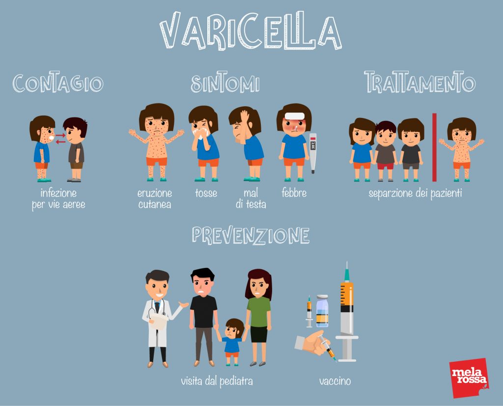 herpes: varicella