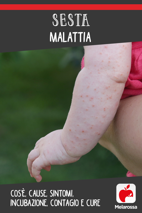 Seta malattia: cos'è, contagio, cause, sintomi e cure