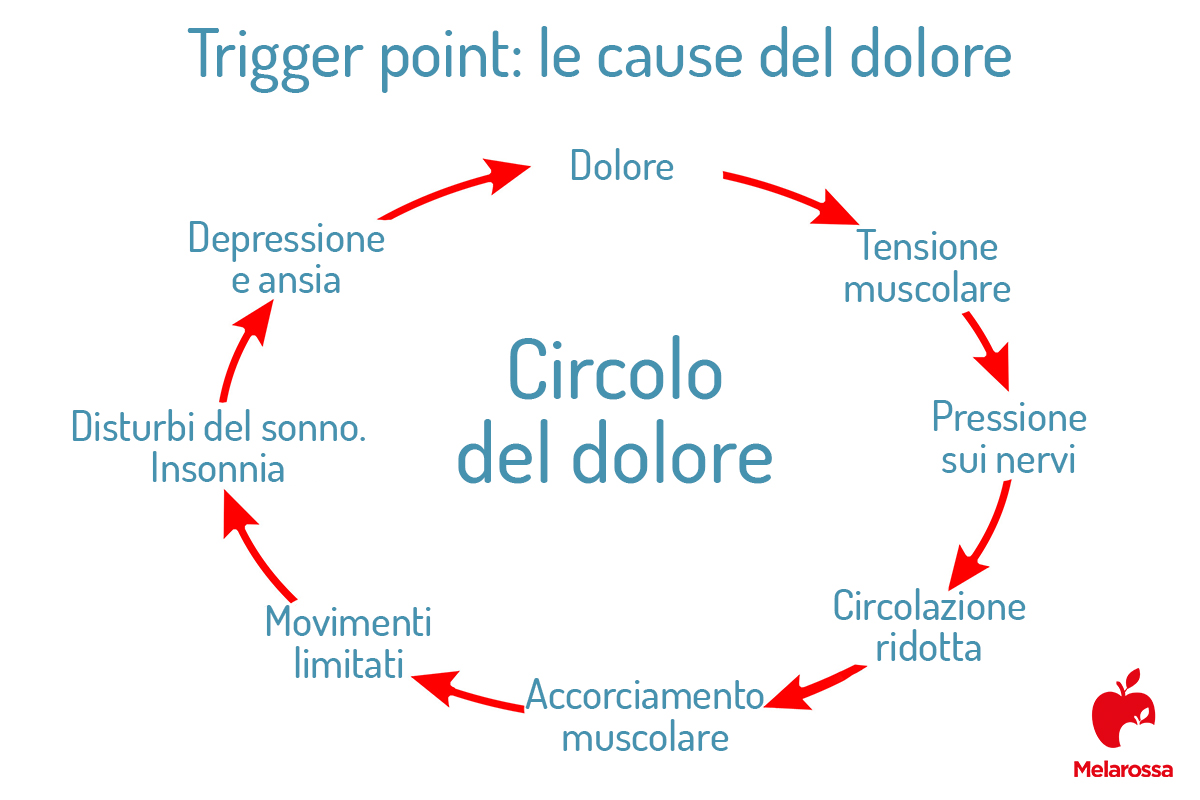 Trigger point: circolo del dolore