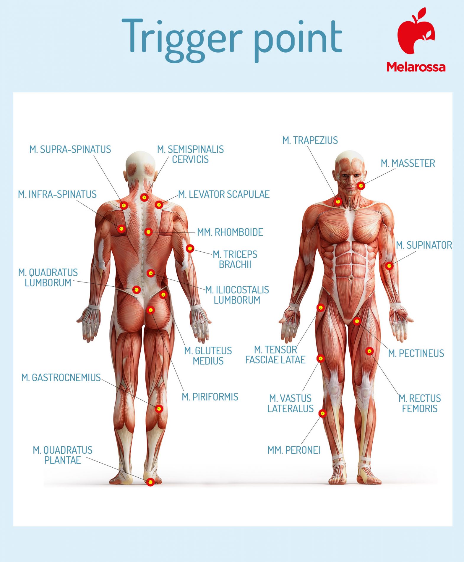 Trigger point caratteristiche 