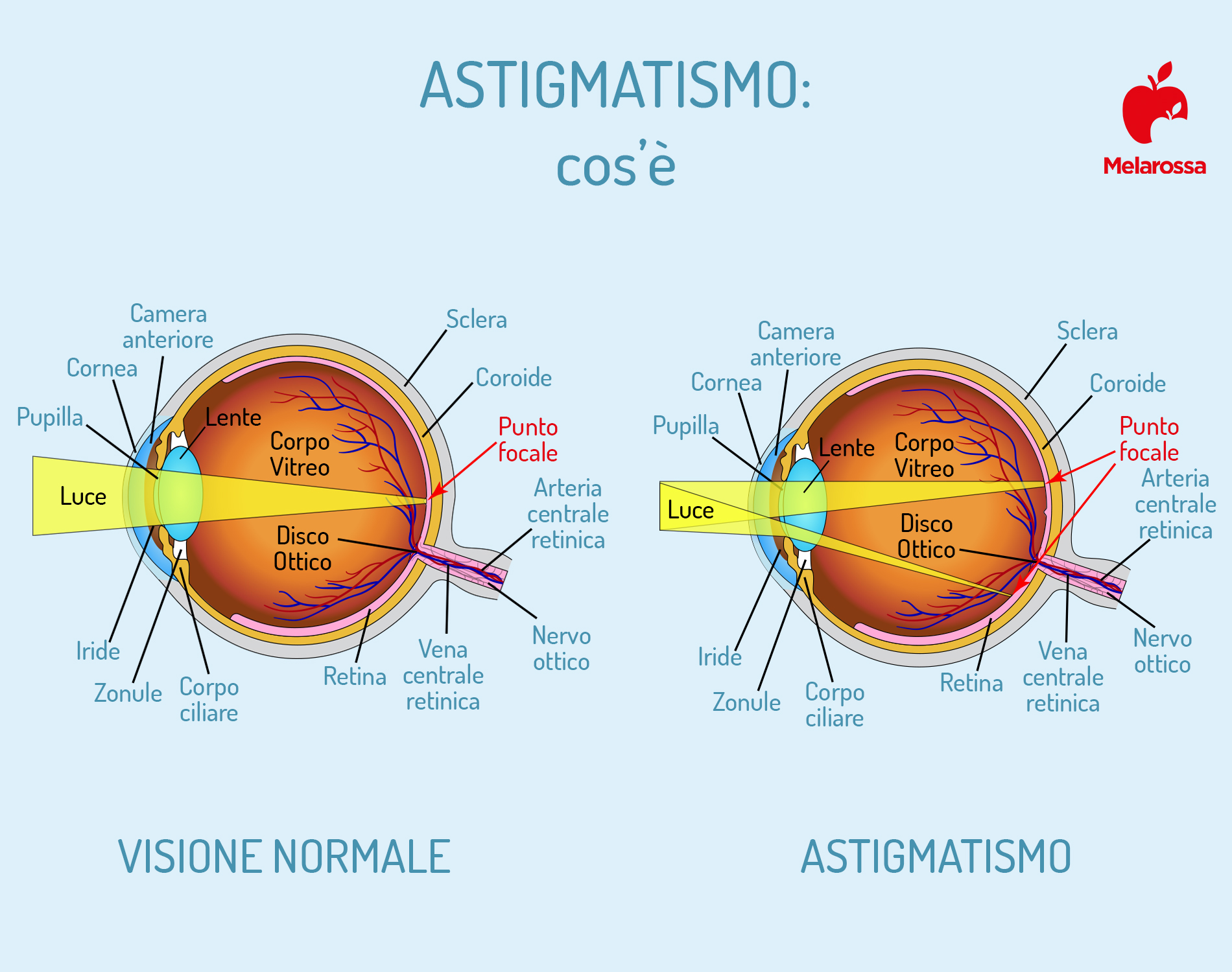 astigmatismo: anatomia dell'occhio