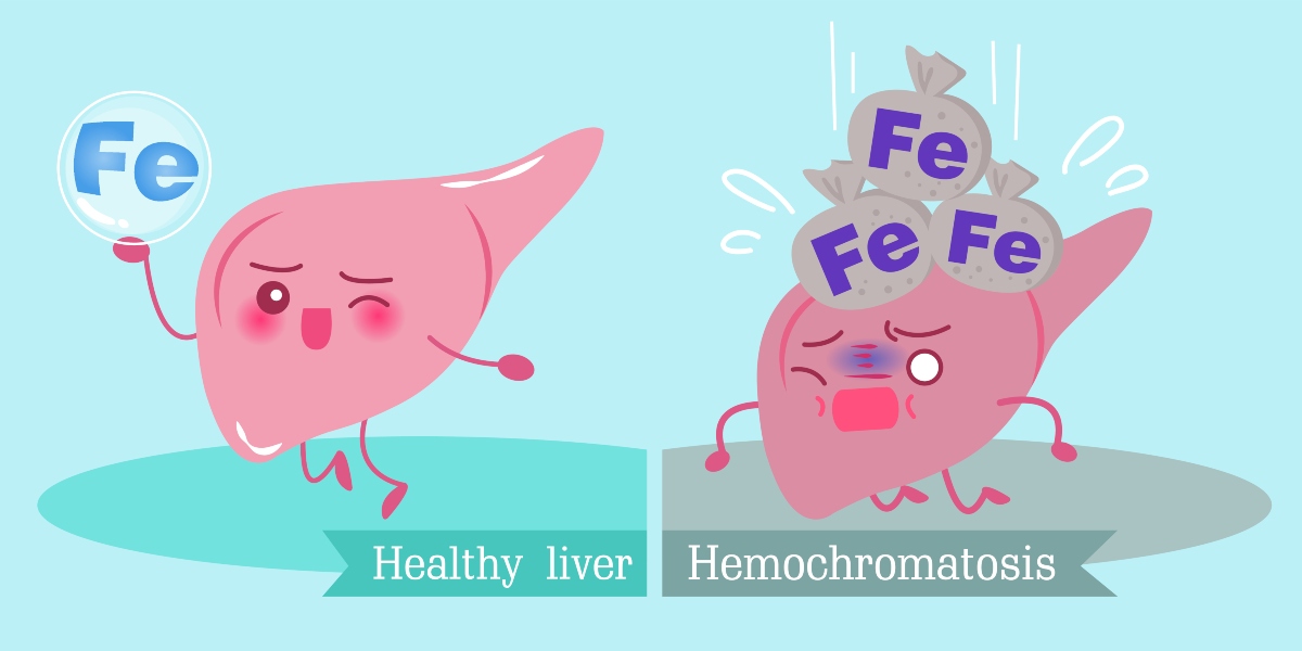 emocromatosi: eccesso di ferro nel sangue