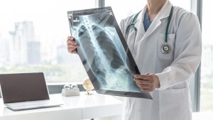 Fibrosi polmonare: cos’è, chi colpisce, cause, sintomi, cure, complicazioni e prevenzione