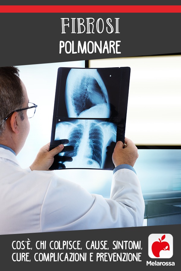 fibrosi polmonare: cos'è, cause, sintomi, cura e prevenzione