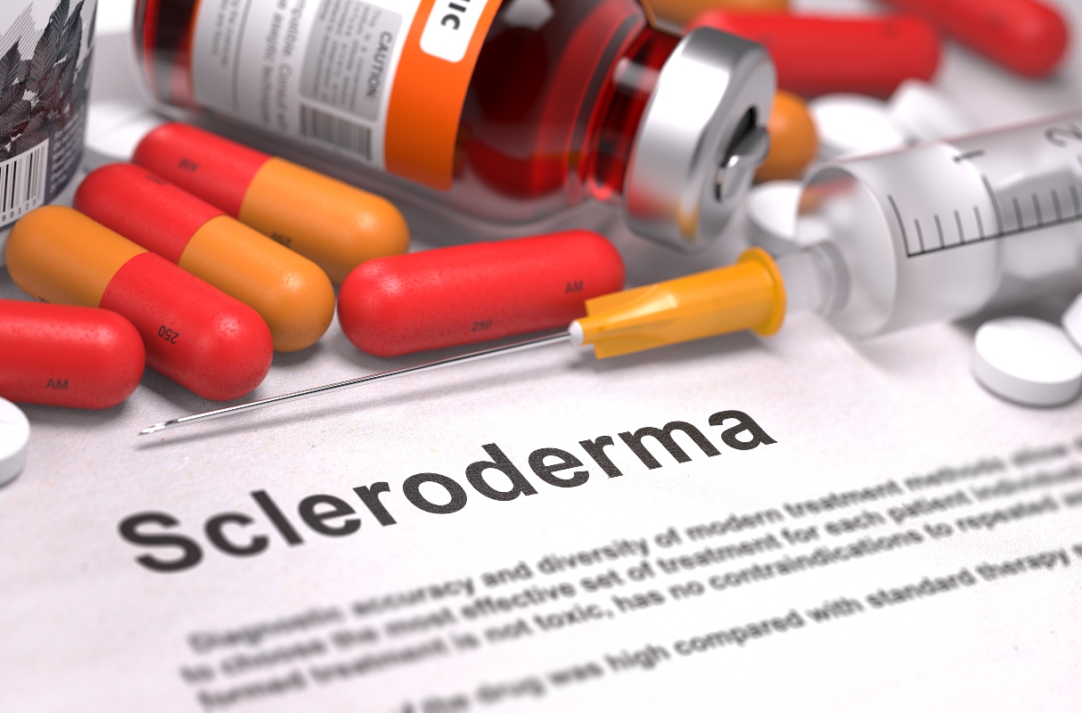 sclerodermia: cure
