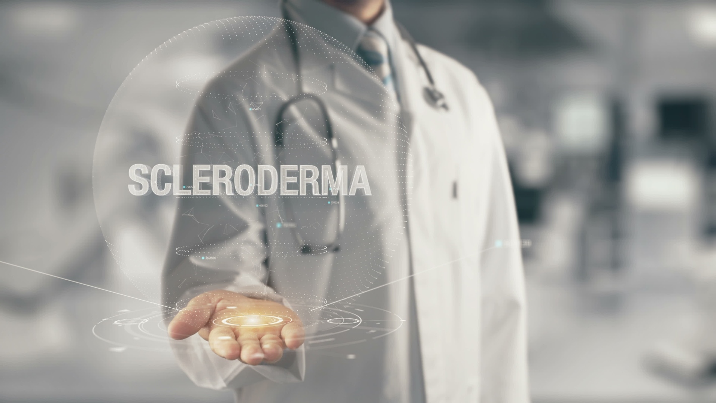 sclerodermia: epidemiologia