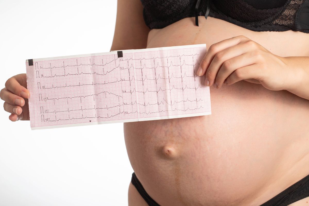 tachicardia in gravidanza