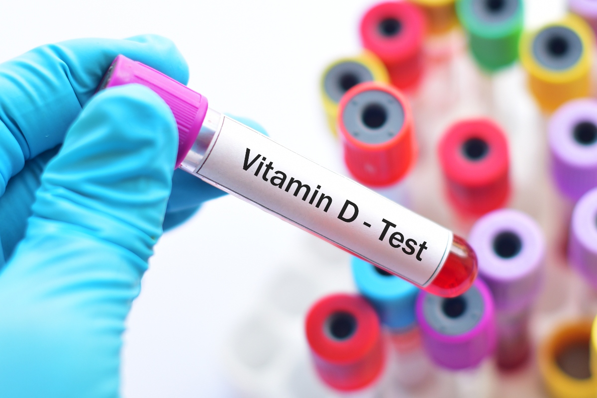 vitamina D: esame del sangue 