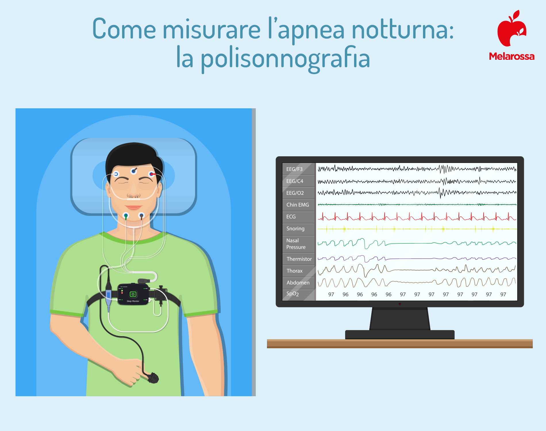 apnea notturna: polisonnografia