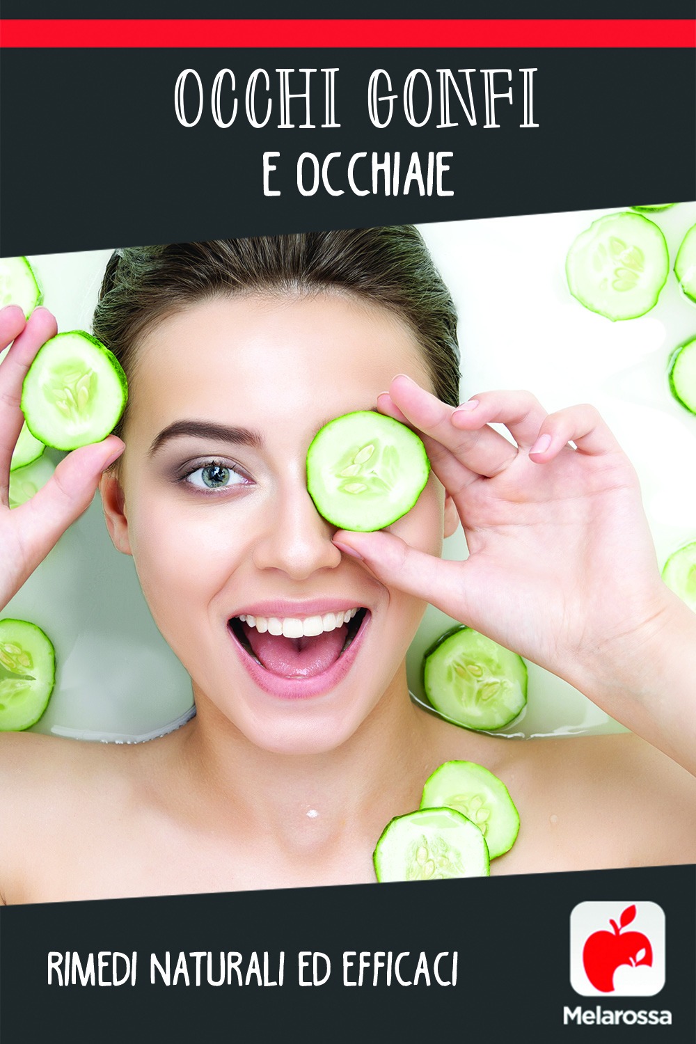 occhi gonfi e occhiaie: rimedi naturali e efficaci
