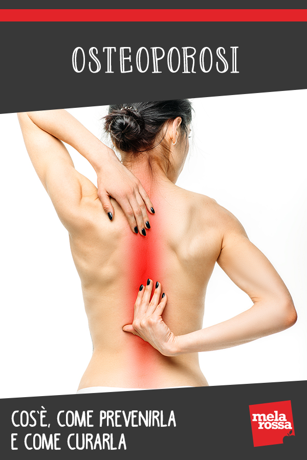 osteoporosi: cos'è, cause, sintomi e cure