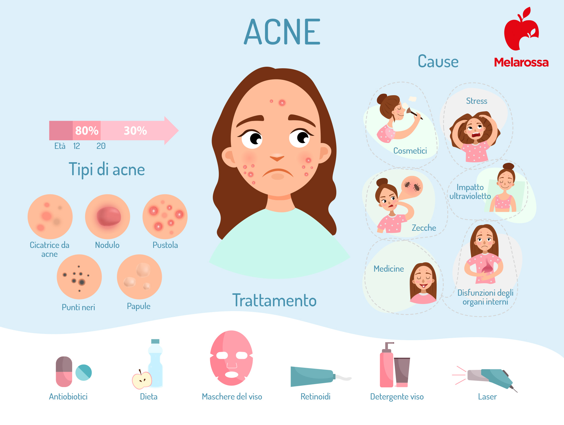 acne: cause, sintomi e cure- infografica 