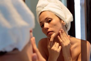 Acne: cos’è, perché compare, classificazione, cause, cura, rimedi e trattamenti