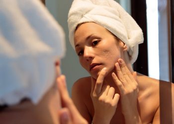 acne: cos'è, tipi, cause, sintomi, cure e trattamenti