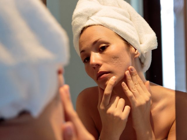 Acne: cos'è, perché compare, classificazione, cura, rimedi e trattamenti